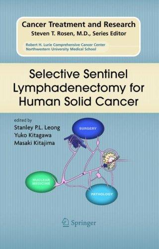 Selective sentinel lymphadenectomy for human solid cancer
