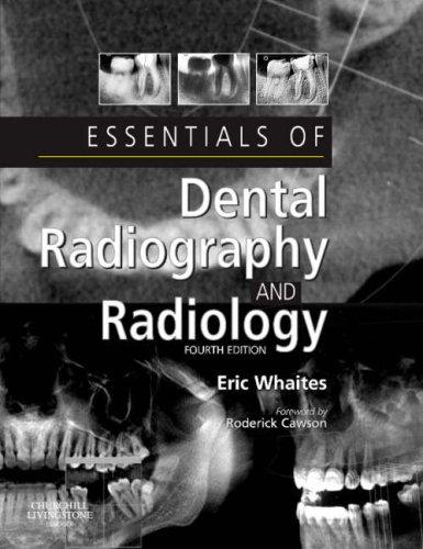 Essentials of dental radiography and radiology
