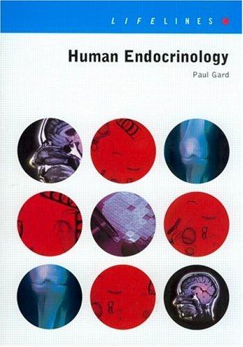 Structured development of parallel programs