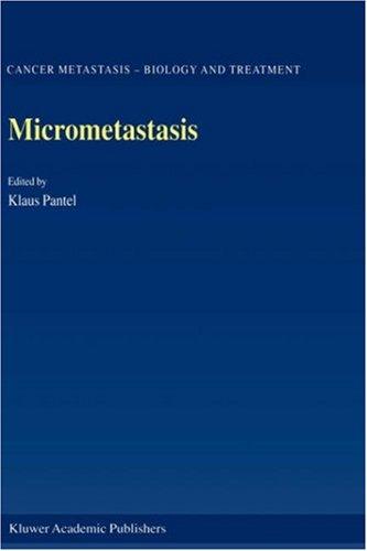 Micrometastasis (Cancer Metastasis - Biology and Treatment)
