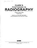 Positioning in radiography