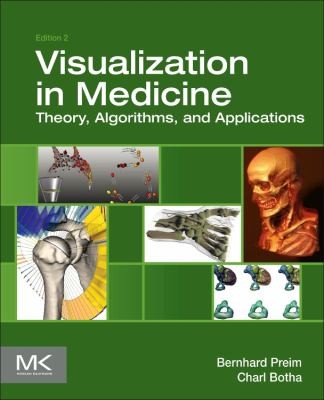 Visual Computing For Medicine Theory Algorithms And Applications by Bernhard Preim cover