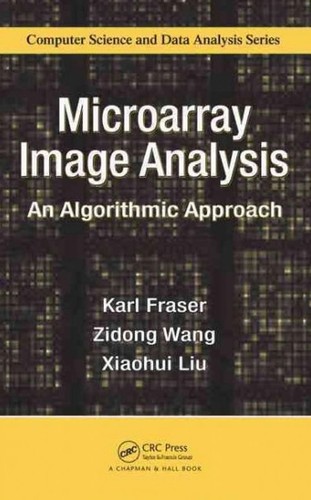Microarray image analysis